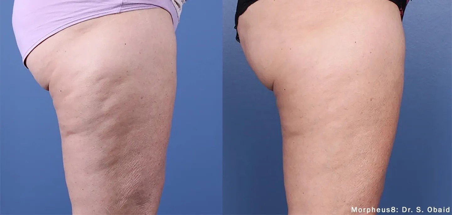 A before and after picture of a person’s leg